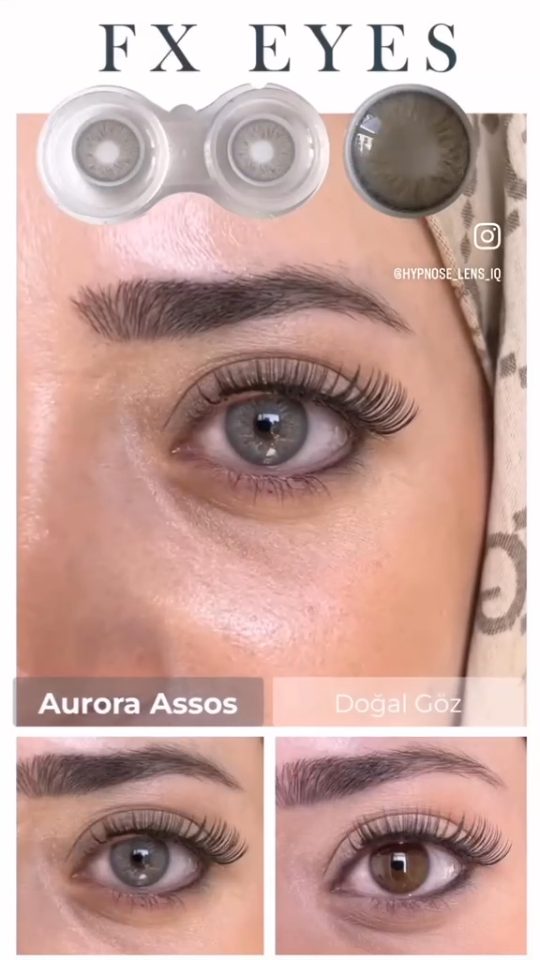 ايرورا اسوس-2